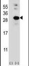 Glyoxalase I antibody, PA5-13601, Invitrogen Antibodies, Western Blot image 