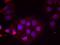 Estrogen Receptor 1 antibody, GTX50139, GeneTex, Immunofluorescence image 