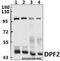 PMS1 Homolog 2, Mismatch Repair System Component antibody, GTX66694, GeneTex, Western Blot image 
