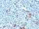 Nerve Growth Factor Receptor antibody, V2766IHC-7ML, NSJ Bioreagents, Immunohistochemistry paraffin image 