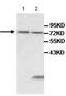 Interleukin 1 Receptor Type 1 antibody, ab106278, Abcam, Western Blot image 