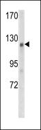 APC Membrane Recruitment Protein 1 antibody, 62-320, ProSci, Western Blot image 