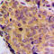 BCL2L2-PABPN1 Readthrough antibody, LS-C353907, Lifespan Biosciences, Immunohistochemistry paraffin image 
