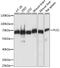 Plastin 1 antibody, GTX66355, GeneTex, Western Blot image 