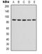 Component Of Inhibitor Of Nuclear Factor Kappa B Kinase Complex antibody, orb338911, Biorbyt, Western Blot image 