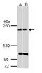 Kinase D Interacting Substrate 220 antibody, NBP1-31216, Novus Biologicals, Western Blot image 