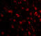 Tau Tubulin Kinase 1 antibody, A09202, Boster Biological Technology, Immunofluorescence image 