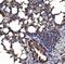 Catenin Delta 1 antibody, A02333-3, Boster Biological Technology, Immunohistochemistry paraffin image 