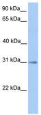 Hydroxyacylglutathione Hydrolase antibody, TA334982, Origene, Western Blot image 