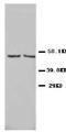 Cytochrome P450 Family 2 Subfamily E Member 1 antibody, PA1116, Boster Biological Technology, Western Blot image 