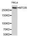 Mechanistic Target Of Rapamycin Kinase antibody, abx127110, Abbexa, Western Blot image 