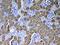 Phenylalanine Hydroxylase antibody, PA5-79780, Invitrogen Antibodies, Immunohistochemistry paraffin image 