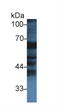Fibrinogen Alpha Chain antibody, LS-C723156, Lifespan Biosciences, Western Blot image 