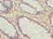 Acidic Residue Methyltransferase 1 antibody, LS-C397400, Lifespan Biosciences, Immunohistochemistry frozen image 
