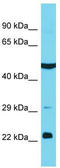 Kelch Repeat And BTB Domain Containing 12 antibody, TA337372, Origene, Western Blot image 