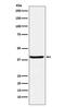 Serpin Family B Member 3 antibody, M04067-2, Boster Biological Technology, Western Blot image 