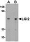 Leucine-rich repeat LGI family member 2 antibody, orb74949, Biorbyt, Western Blot image 
