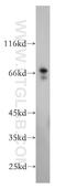 MAGE Family Member A6 antibody, 14602-1-AP, Proteintech Group, Western Blot image 
