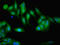 Gelsolin antibody, orb350501, Biorbyt, Immunocytochemistry image 
