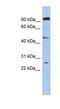 Chromosome 1 Open Reading Frame 174 antibody, NBP1-70453, Novus Biologicals, Western Blot image 