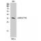 NFKB Inhibitor Beta antibody, LS-C380899, Lifespan Biosciences, Western Blot image 