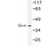 G Protein Subunit Alpha Z antibody, LS-C177329, Lifespan Biosciences, Western Blot image 