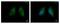 Methylcrotonoyl-CoA Carboxylase 2 antibody, NBP2-17237, Novus Biologicals, Immunofluorescence image 