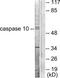 Protein Phosphatase Methylesterase 1 antibody, TA312376, Origene, Western Blot image 