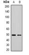Muscleblind Like Splicing Regulator 1 antibody, orb341426, Biorbyt, Western Blot image 