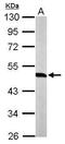 WRS antibody, GTX110223, GeneTex, Western Blot image 