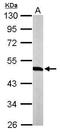 Tryptophanyl-TRNA Synthetase antibody, GTX110223, GeneTex, Western Blot image 