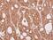 Centrosomal Protein 57 antibody, PA5-30551, Invitrogen Antibodies, Immunohistochemistry paraffin image 