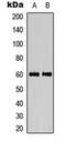 Calcium/Calmodulin Dependent Protein Kinase IV antibody, LS-C358930, Lifespan Biosciences, Western Blot image 