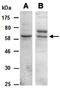Killer Cell Lectin Like Receptor G1 antibody, orb67024, Biorbyt, Western Blot image 