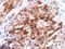 Glypican 3 antibody, M01922, Boster Biological Technology, Immunohistochemistry paraffin image 