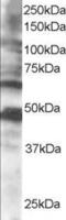 Cytoplasmic Polyadenylation Element Binding Protein 1 antibody, 45-425, ProSci, Western Blot image 