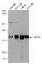 Large Tumor Suppressor Kinase 1 antibody, GTX131532, GeneTex, Western Blot image 