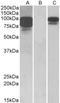 Proprotein Convertase Subtilisin/Kexin Type 9 antibody, LS-C139568, Lifespan Biosciences, Western Blot image 