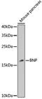 Natriuretic Peptide B antibody, 18-554, ProSci, Western Blot image 