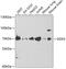 DEAD-Box Helicase 5 antibody, GTX54031, GeneTex, Western Blot image 