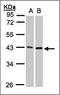 Matrix Metallopeptidase 3 antibody, AP23149PU-N, Origene, Western Blot image 