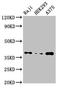 Serine/threonine-protein phosphatase PP1-beta catalytic subunit antibody, LS-C679122, Lifespan Biosciences, Western Blot image 