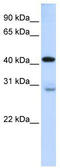 GRAM Domain Containing 2A antibody, TA336109, Origene, Western Blot image 