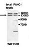 ADNP Homeobox 2 antibody, orb77497, Biorbyt, Western Blot image 