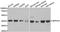 Selenophosphate Synthetase 1 antibody, LS-C334730, Lifespan Biosciences, Western Blot image 