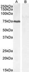 Protein Phosphatase 1 Regulatory Subunit 15A antibody, 45-649, ProSci, Western Blot image 