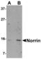 Norrin Cystine Knot Growth Factor NDP antibody, MBS150479, MyBioSource, Western Blot image 