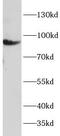 Ribosomal Protein S6 Kinase A1 antibody, FNab10333, FineTest, Western Blot image 