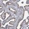 Dynein Axonemal Light Intermediate Chain 1 antibody, NBP1-84222, Novus Biologicals, Immunohistochemistry paraffin image 