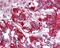 PDLIM1 Interacting Kinase 1 Like antibody, orb330704, Biorbyt, Immunohistochemistry paraffin image 